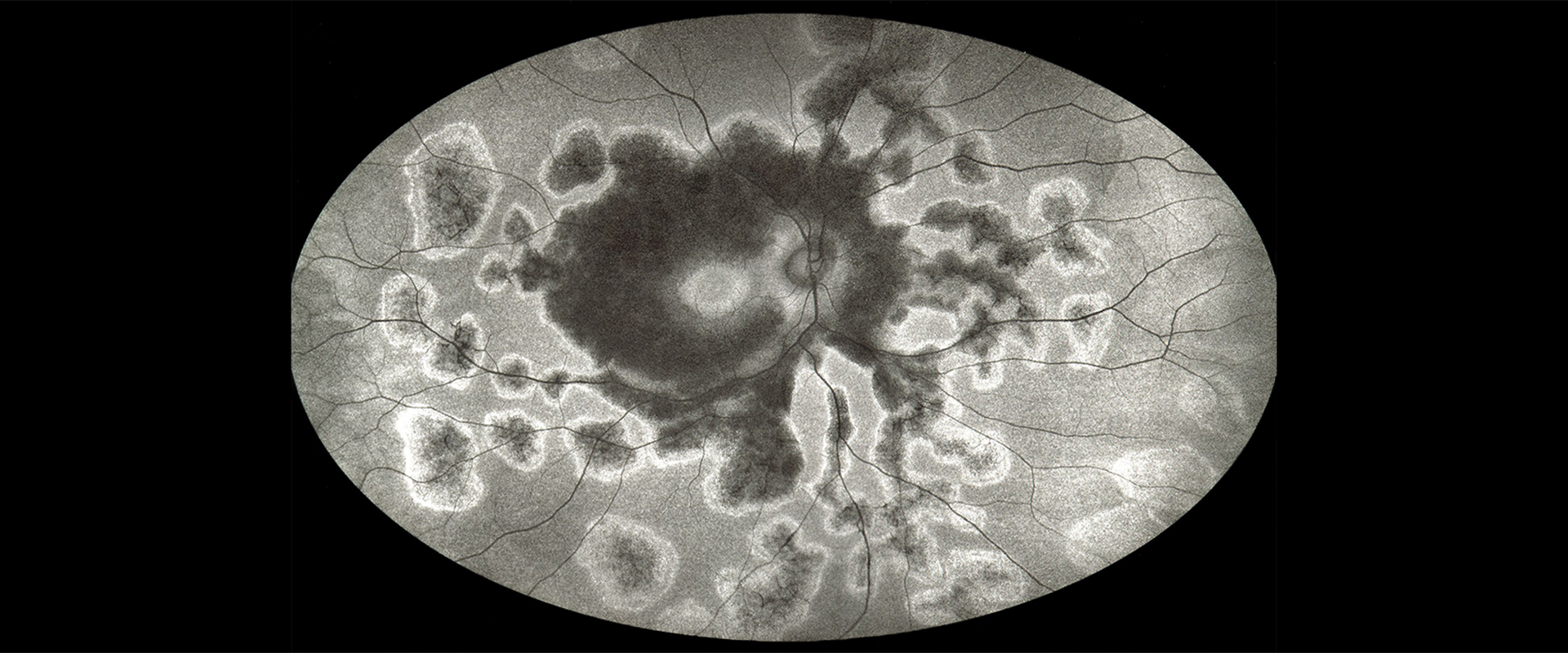 Ophthalmic Photographers Society