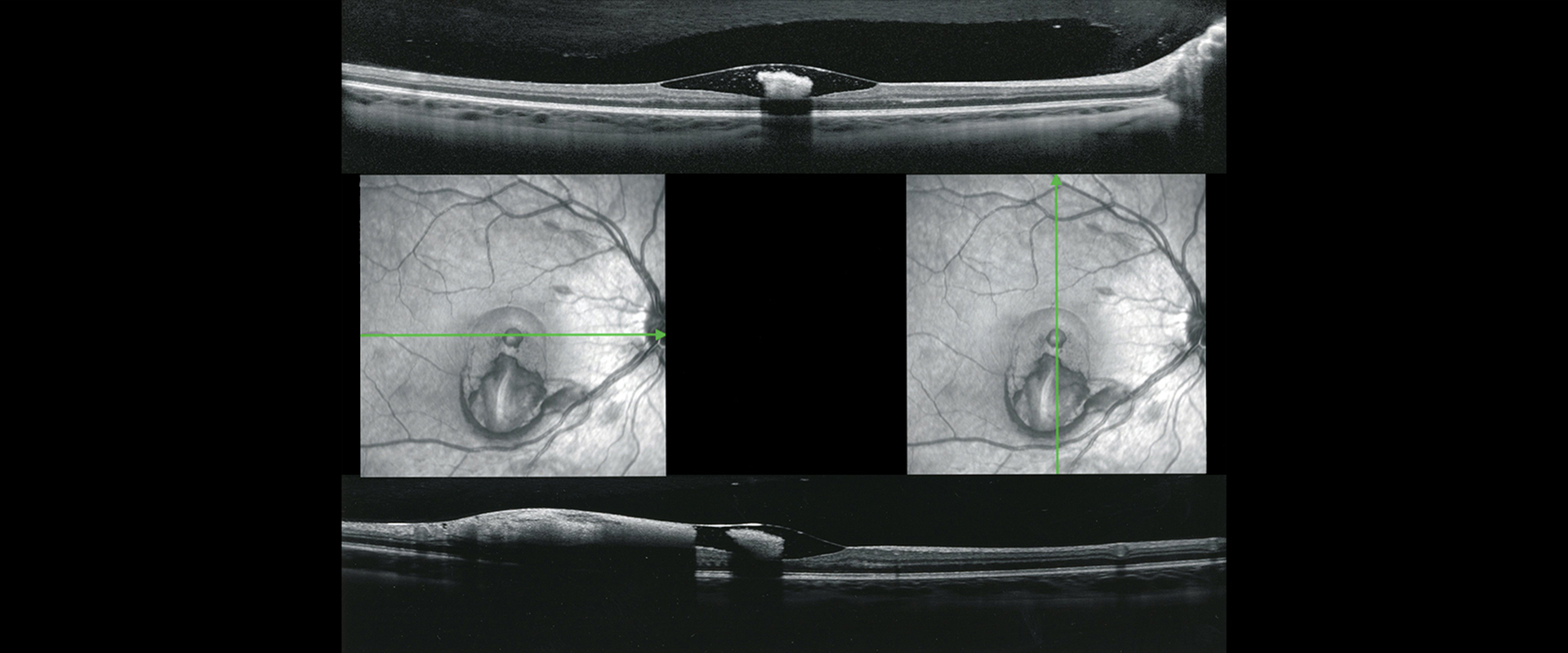 Ophthalmic Photographers Society